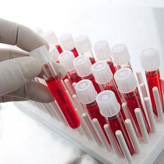 Група крові та здоров'я: нові дослідження