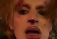 Бійка у Львові з трансгендером ЗСУ