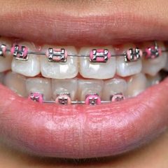 Ортодонт в кабинете с пациентом