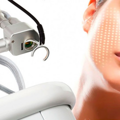 Применение фракционных лазеров в косметологии