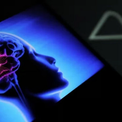 Мозковий імплантат – покращення настрою