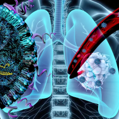 Nanoparticles for treating lung cancer
