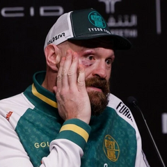 Лицо Фьюри после ударов Усика