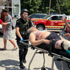 Раненые люди из-за обстрелов Днепропетровщины