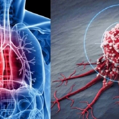 Людство на грани революции в лечении рака