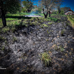 Жінка з опіками від підпалу трави