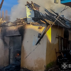 Жінка з опіками через пожежу