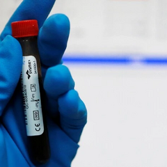 Перевірка учасників на допінг