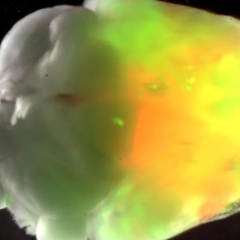 Human brain tissue grown in mice