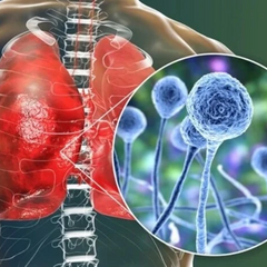 Графік, що зображає поширення нової глобальної загрози здоров'ю