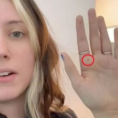 Фото долоні британки та порада