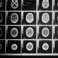 Штучний інтелект Microsoft діагностика захворювань