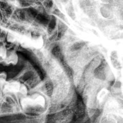 Material for bone tissue regeneration