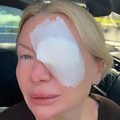 Ждет операции по удалению ячменя