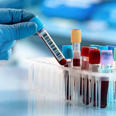 Тестування на ВІЛ, гепатити та туберкульоз