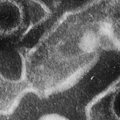 Ученые из США разработали 10 антител для блокировки вируса Эпштейна-Барр и снижения риска онкологии