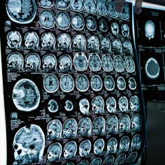 Latest MRI antenna will enhance diagnostic accuracy