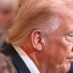 Красные пятна и синяки на Трампе