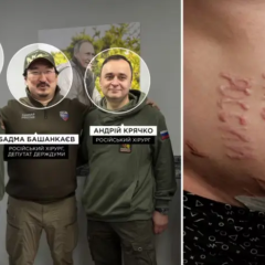 Российские хирурги сделали на теле заключенного надпись 'слава россии'