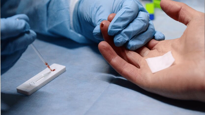 Эпидемия гепатита А в Киеве