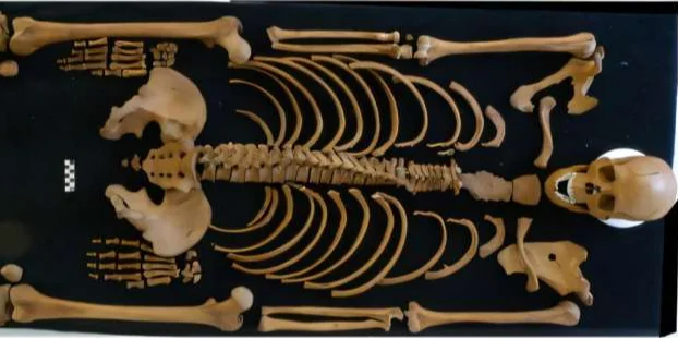 Unraveling the 2,000-Year-Old Mystery Behind a Roman Soldier’s Death in a Dutch Fort