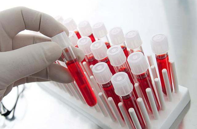 Група крові та здоров'я: нові дослідження