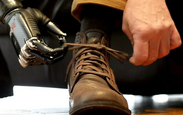 Почти 50 тысяч украинцев с травмами