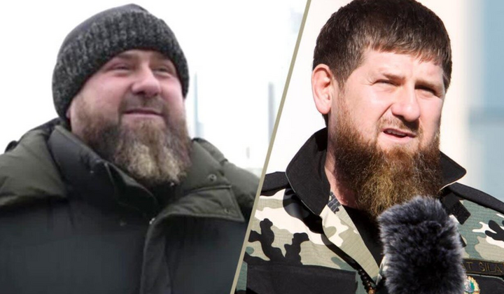 Изображение Рамзана Кадырова. Детали о его болезни