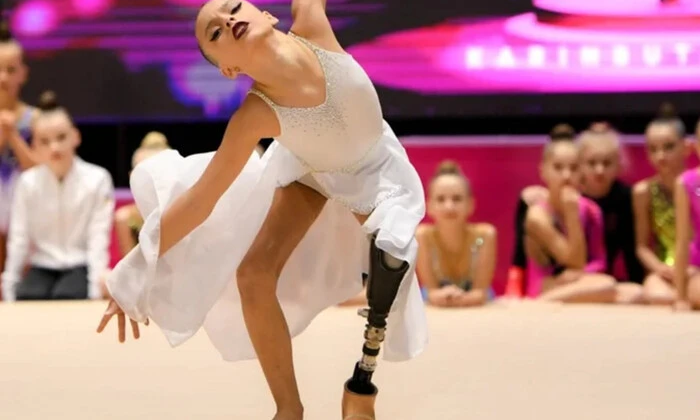 Nine-year-old gymnast in a plaster prosthesis
