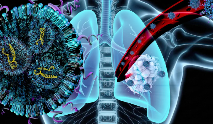 Nanoparticles for treating lung cancer