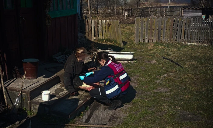 Женщина потеряла сознание и упала в огонь