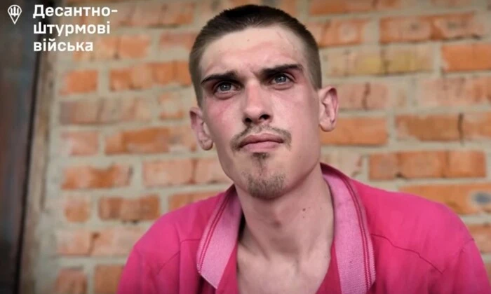 Полонений зі зламаною щелепою розповідає про жорстокість РФ