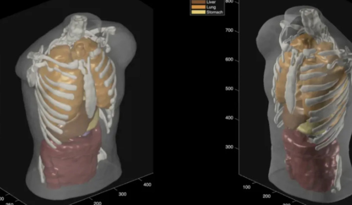 Midjourney's first full-fledged ultrasound scanner