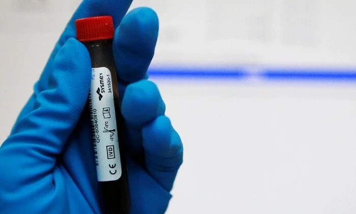 Перевірка учасників на допінг