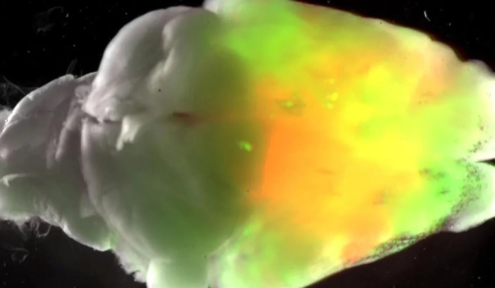 Human brain tissue grown in mice