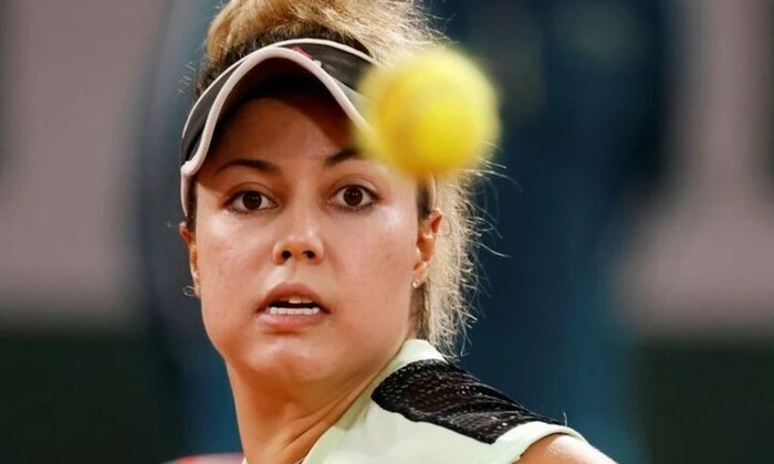 Renata Saracua with sunburn