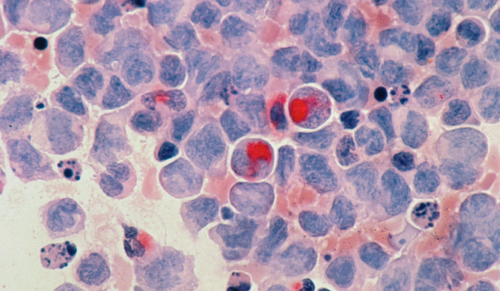 Role of PPARD protein in boosting immunity
