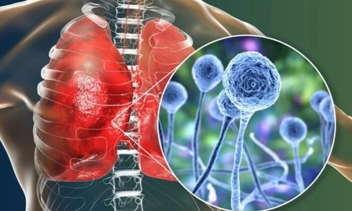 Графік, що зображає поширення нової глобальної загрози здоров'ю