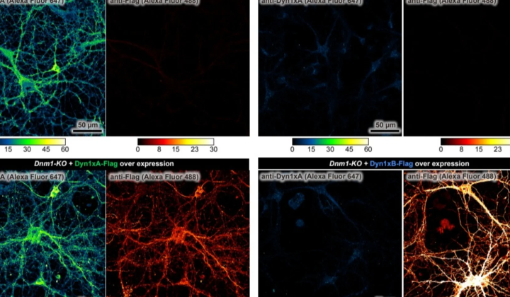 Axons of nerve cells in thread-like shape