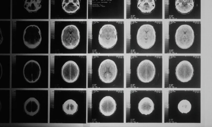 Штучний інтелект Microsoft діагностика захворювань