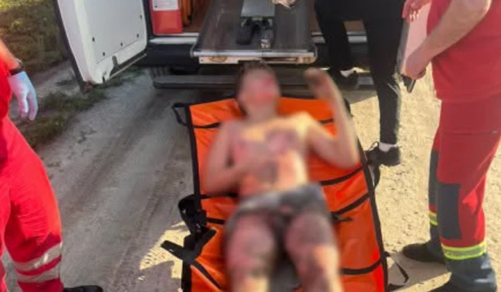 Teenager electrocuted on train roof