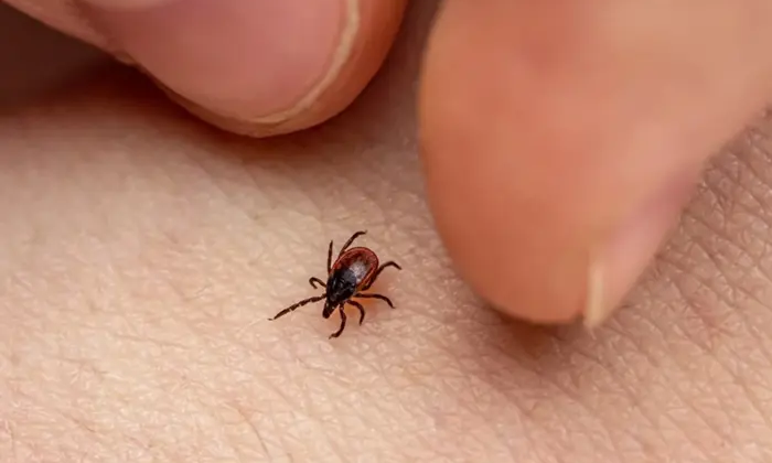 Бореліоз на Вінниччині: зараженість та захист