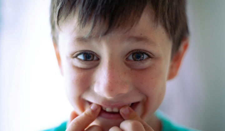 Children with tooth decay
