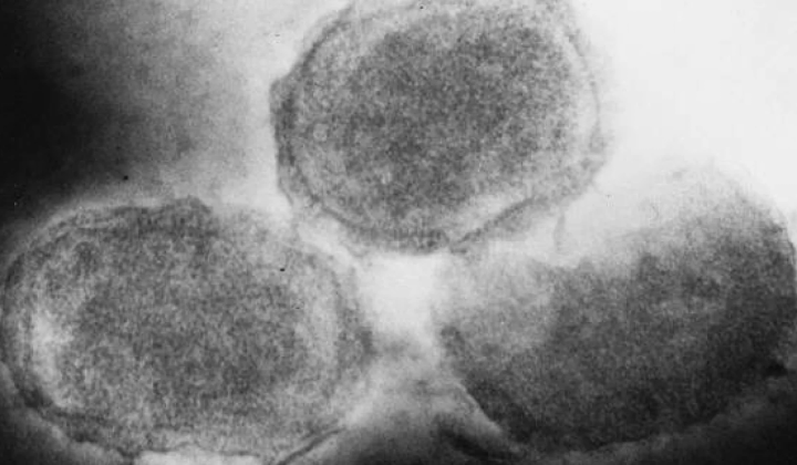 Gene BC200 fragments in virus