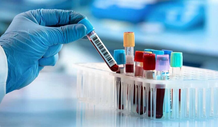 Тестування на ВІЛ, гепатити та туберкульоз