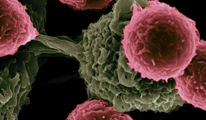 Protein overcoming resistant tumors