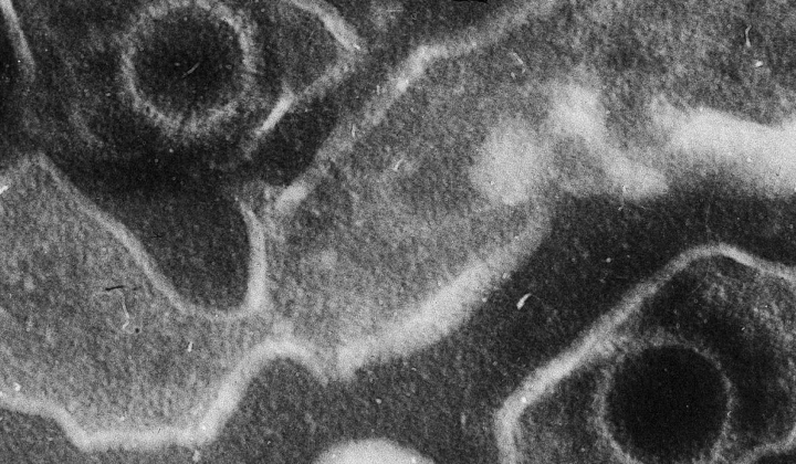 10 antibodies blocking Epstein-Barr virus