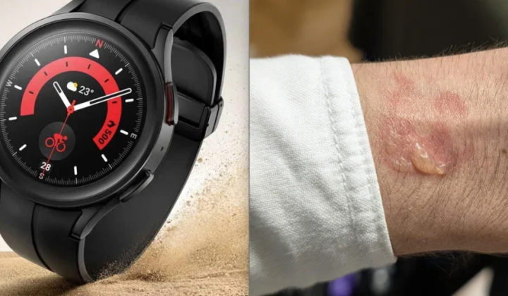Власники Samsung Galaxy Watch скаржаться на подразнення шкіри та швидку розрядку батареї