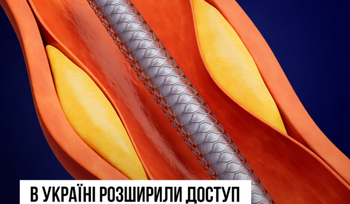 Человек получает стентирование сердца бесплатно
