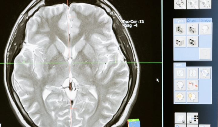 Statistical link between bacteria and psychopathic traits